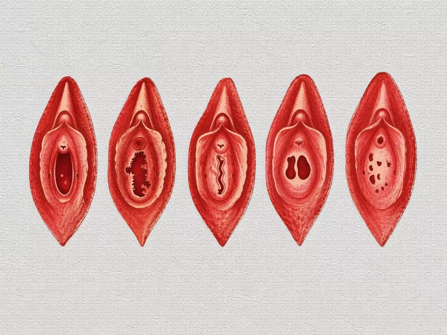 Corrección de malformaciones del tracto genital inferior con la Dra. Sofía Torres especialista en cirugía ginecológica y salud íntima femenina en Córdoba Capital.